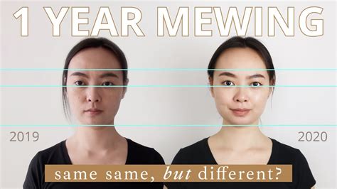 Mewing Technique Coined By Dr Mike Mew Changes Face Shape Daily Mail