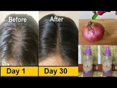 In hope of seeing those new hair strands on your scalp, are you tired of using expensive products and failing every single time? Hair Growth Spray Use Vitamin E Oil mixed with Onion juice ...