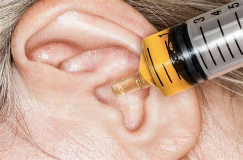 5 Ways How To Treat Itchy Ears Grandmas Things