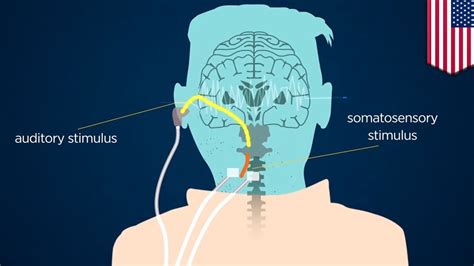 Tinnitus Research New Electric Device Improves Life Of Tinnitus