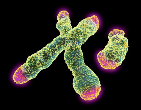 X And Y Chromosome With Telomeres Photograph By Pasieka Pixels
