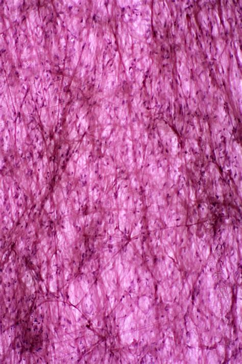 Areolar Connective Tissue Lm Photograph By Science Stock Photography