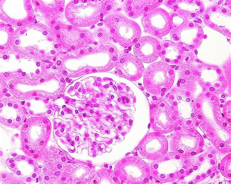 Kidney Glomerulus Photograph By Jose Calvo Science Photo Library