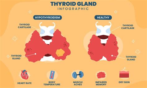 What Is Thyroid Cancer FITPAA