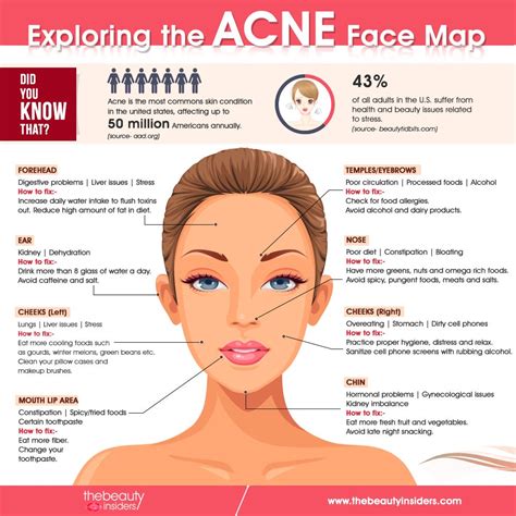 Acne Face Map Know What Does Acne Reveal About Your Health By Mia Ray Medium