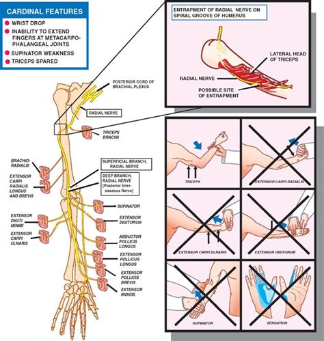 Peripheral Nerves Neupsy Key Peripheral Nerve Median Nerve