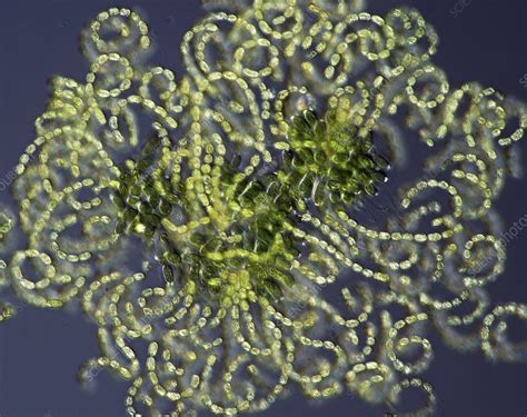 Anabaena Cyanobacteria Light Micrograph Stock Image C0289181