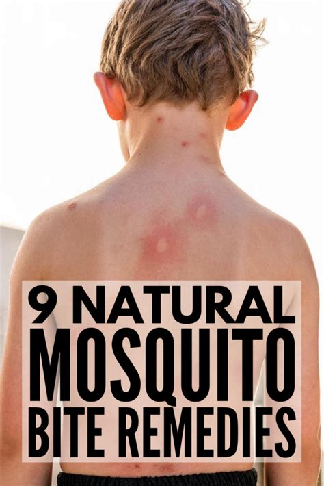 9 natural mosquito bite remedies that work mosquito bites don t just make you itchy they can
