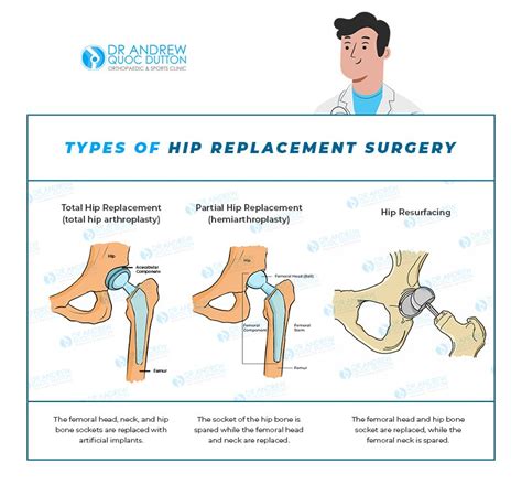 7 Signs That A Hip Replacement Surgery Might Be Needed