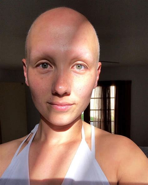Women With No Eyebrows Explain Why Arches Aren T Necessary Allure