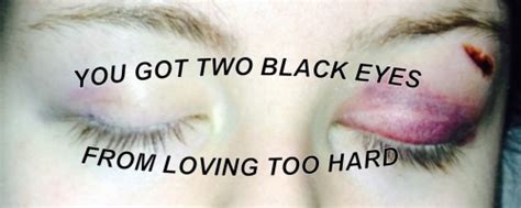 black eyes on tumblr