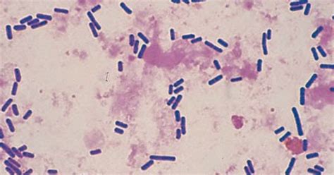 This genus includes several significant human pathogens, including the causative agents of botulism and tetanus. Intoxicación Clostridium perfringes ~ Microbiologia de los ...