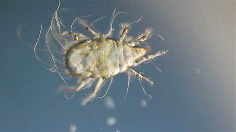 Dust Mite Under The Microscope Youtube