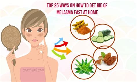 Top 19 Ways On How To Get Rid Of Melasma Fast At Home