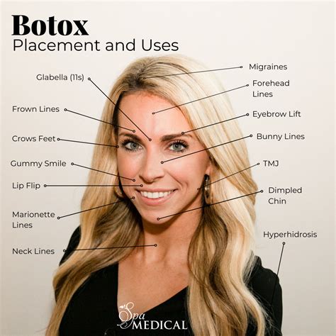 What Is Botox And How Does It Work Spa Medical