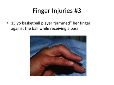 Ppt Sports Related Hand And Wrist Injuries Powerpoint Presentation