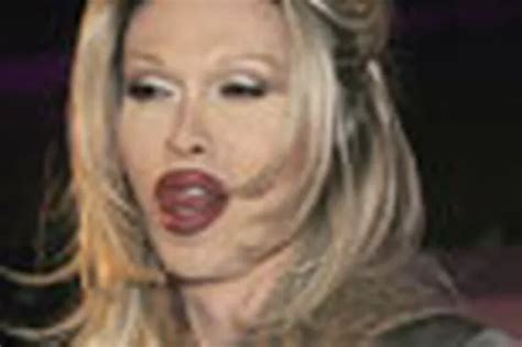Pete Burns Wins K Compensation From Plastic Surgeon Over Botched Operation Daily Record