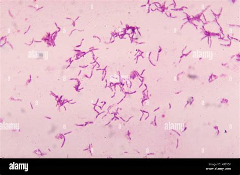 Lactobacillus Bulgaricus Colony Morphology