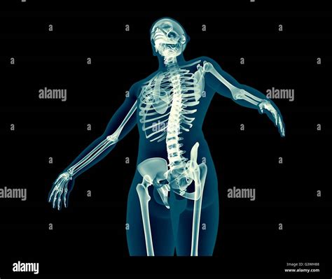 menschliches skelett röntgen fotos und bildmaterial in hoher auflösung alamy