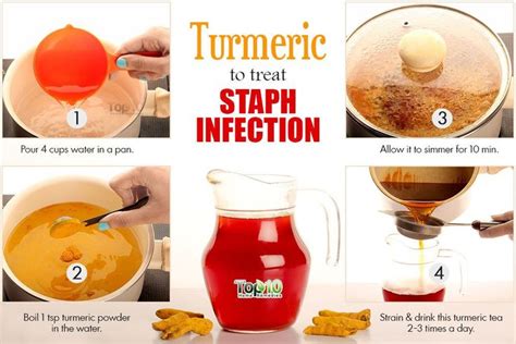 Staph Infection Prevention And Home Remedies Top 10 Home Remedies