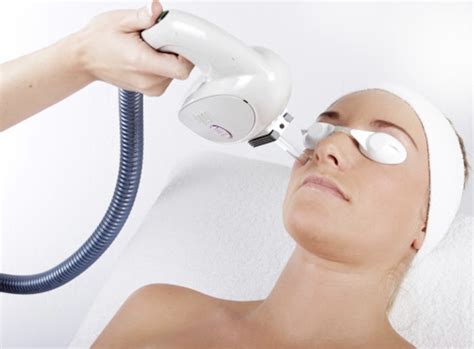 Laser Photo Rejuvenation Skin N Tonic Aesthetics