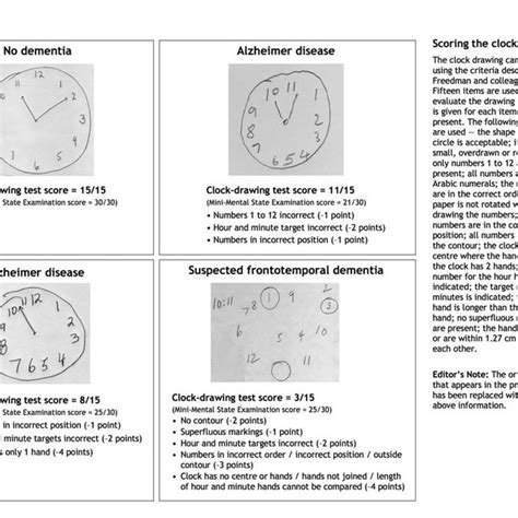 Clock Drawings And Test Scores For Patients Without Dementia And Those