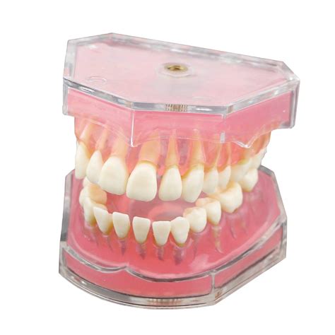 Buy Dentalmall Dental Demonstration Teeth Model Standard Study