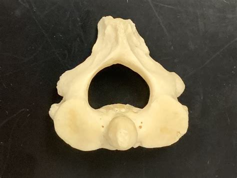 Cervical Vertebrae Axis C2 Diagram Quizlet