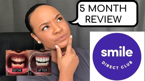Smile Direct Club Is It Worth It Must Watch Review Pics Youtube