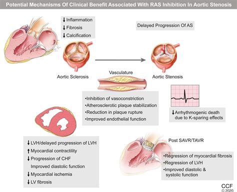 Renin‐angiotensin System Blockade In Aortic Stenosis Implications