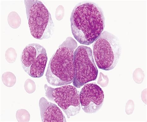 Body Fluid Analysis In The Hematology Laboratory Rodaks Hematology