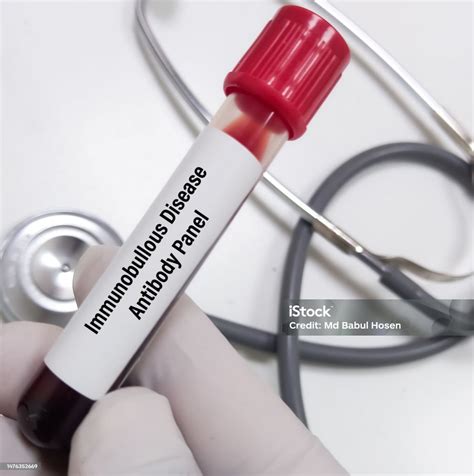 Ilmuwan Memegang Sampel Darah Untuk Tes Panel Antibodi Penyakit