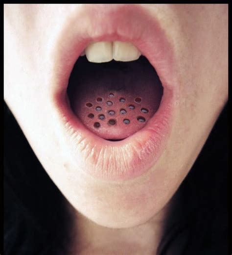 Warning Do Not Look At These Photos If You Re Afraid Of Holes What S Trypophobia Memes