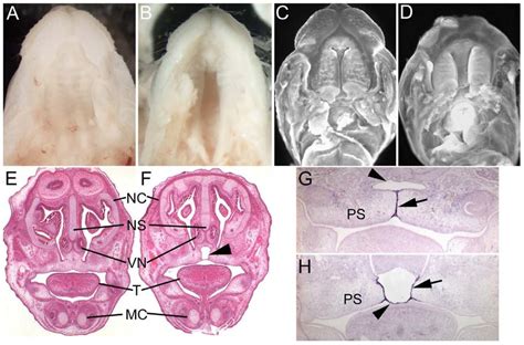 Morphology Of The Palate In Fras1 Ace And G And Fras1 Bfbbfb