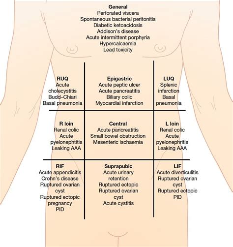 Acute Abdominal Pain And Starting Ddx By Quadrant Doctor Stuff