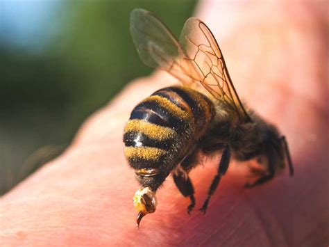 Those are the insect stings that most the severity of symptoms from a sting varies from person to person. How Is an Infected Bee Sting Treated?