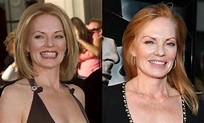 Marg Helgenberger Plastic Surgery Before And After Facelift, Botox Photos