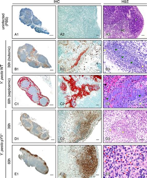 Progression Of Histopathology In The Draining Lymph Nodes Of Rats After