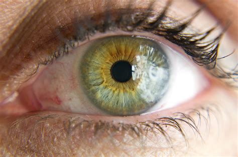 Green Eye With Heterochromia Central