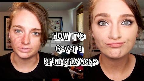 How To Cover A Birthmarkacne Youtube