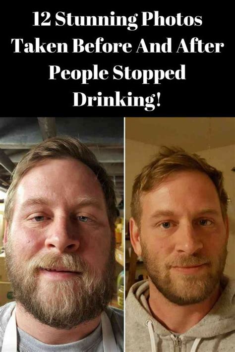 12 Stunning Photos Taken Before And After People Stopped Drinking Not