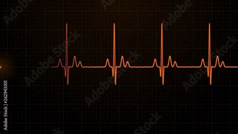 Loopable Orange Ekgecg Cardiogram Oscilloscope Monitor Heartbeat