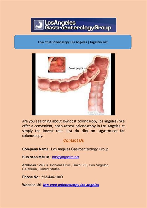 Ppt Low Cost Colonoscopy Los Angeles Powerpoint