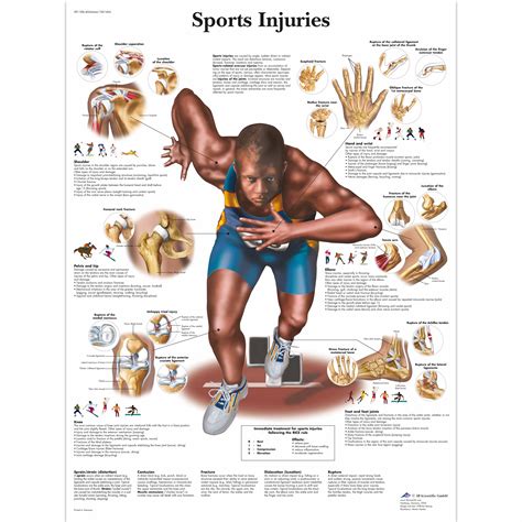 Sports Injuries Chart 4006664 Vr1188uu Muscle 3b Scientific