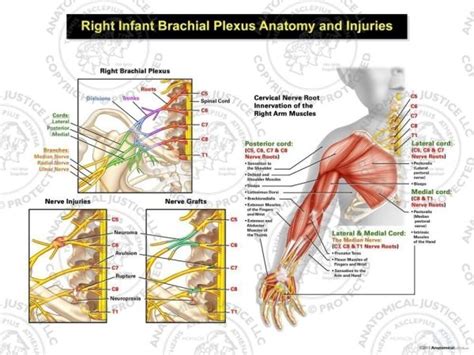 Right Infant Brachial Plexus Anatomy And Injuries