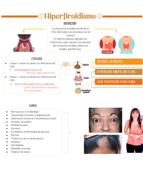 Hipertiroidismo Mapa Conceptual Definicin La Hormona Tiroidea Sexiz Pix