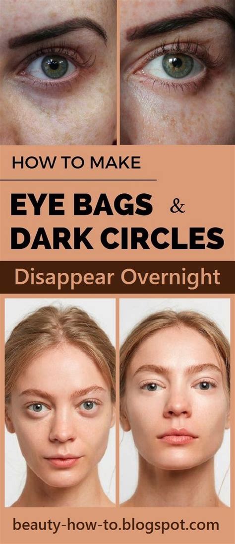 How To Make Eye Bags And Dark Circles Disappear Overnight Eye Bags