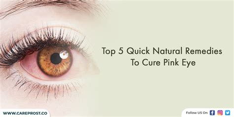 Top 5 Quick Natural Remedies To Cure Pink Eye
