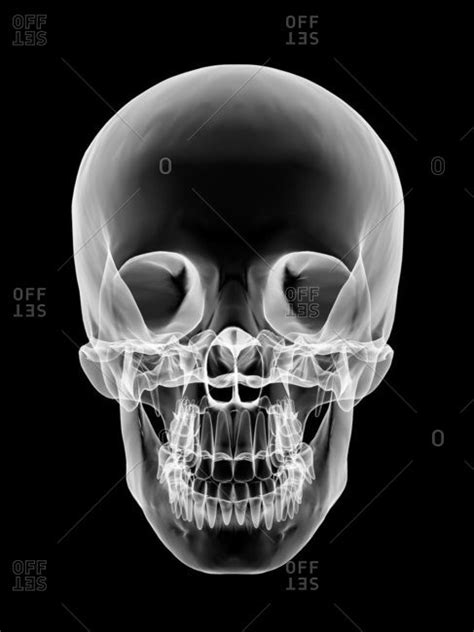 Human Skull X Ray Artwork Offset Stock Photo Offset