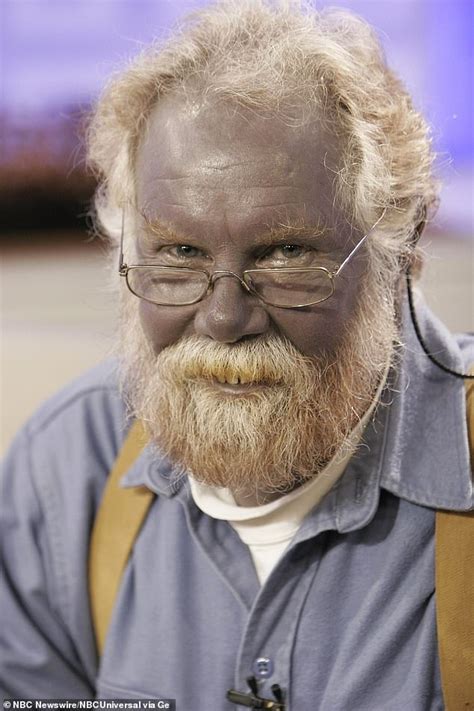 The Real Life Papa Smurf Man Turned Himself Blue After Taking Dietary